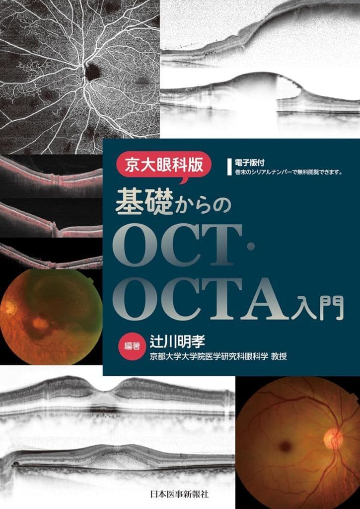 駿河屋 -<中古><<医学>> 京大眼科版 基礎からのOCT・OCTA入門 / 辻川明