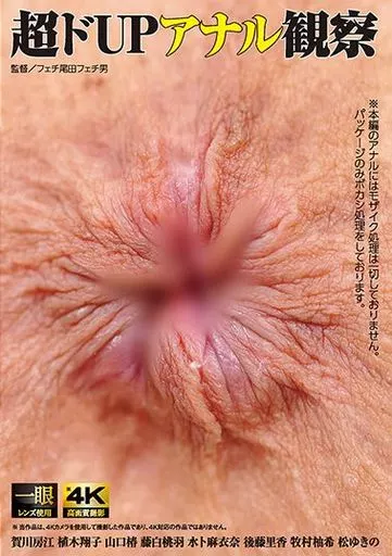 超ドUPアナル観察