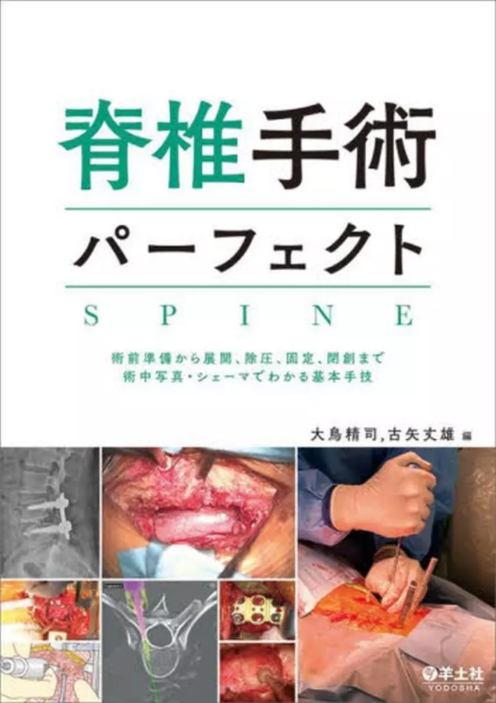 医学 脊椎手術パーフェクト / 大鳥精司 / 古矢丈雄