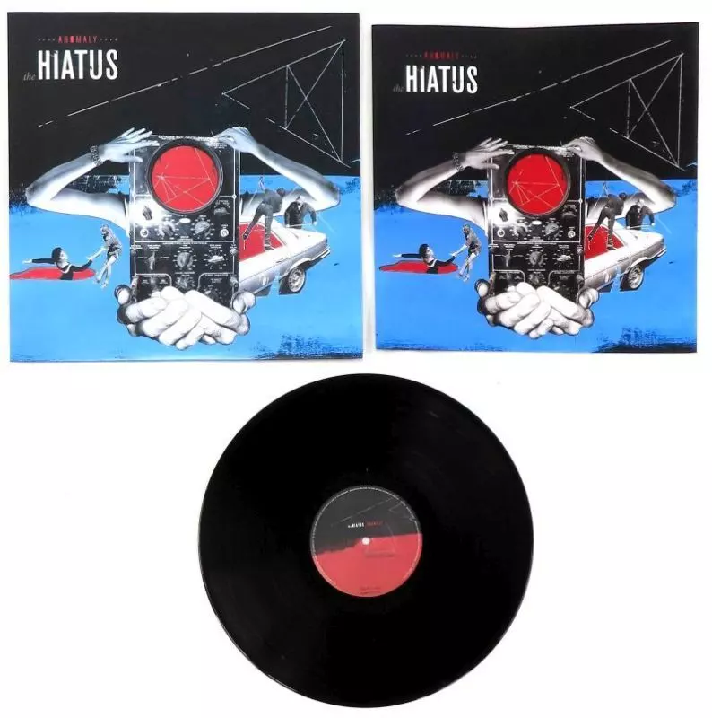 駿河屋 -<中古>the HIATUS / ANOMALY（邦楽）